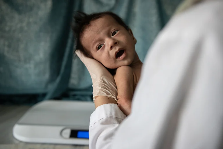 Baby Hakem wordt behandeld in onze kliniek in Afghanistan