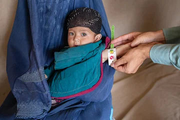 Abdul zit bij zijn moeder. Met een meetlint wordt gecontroleerd of hij ondervoed is. De gele kleur geeft aan dat hij niet op een gezond gewicht zit.